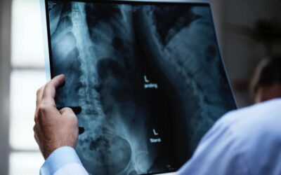 Les assurances complémentaire santé